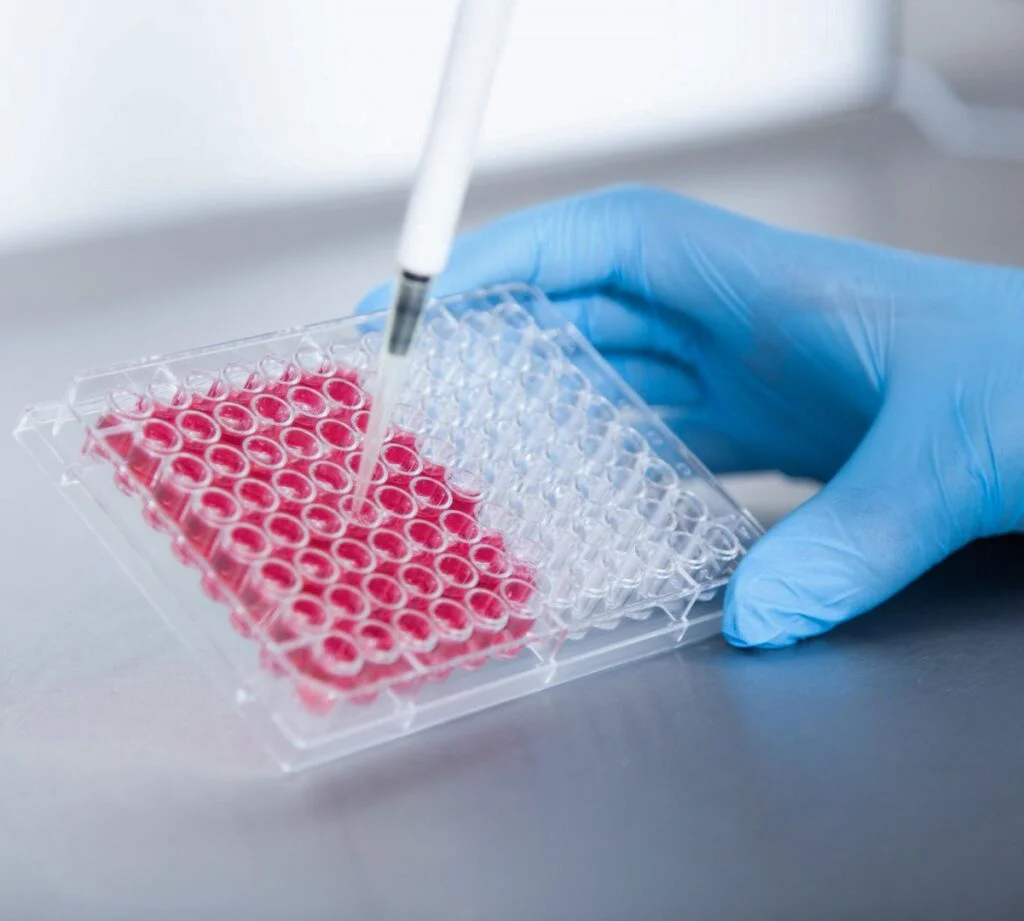 Terapia con Células Madre